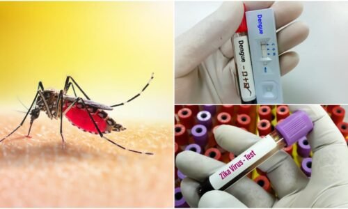 ರಾಜ್ಯದಲ್ಲಿ ನಿನ್ನೆ 175 ಮಂದಿಗೆ ಡೆಂಘೀ ಜ್ವರ: ಝೀಕಾ ವೈರಸ್ ಗೆ ಮೊದಲ ಸಾವು